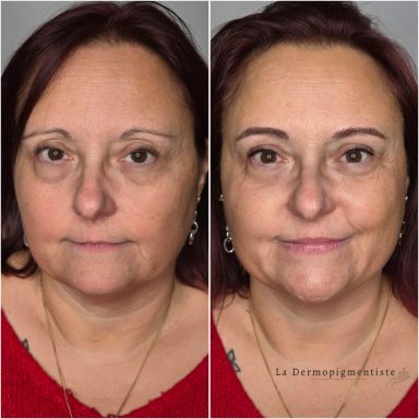 Portrait d'une femme avec une transformation visible, avant et après un traitement.