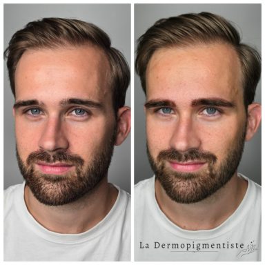 Homme souriant avec une barbe, avant et après un traitement de soins du visage.