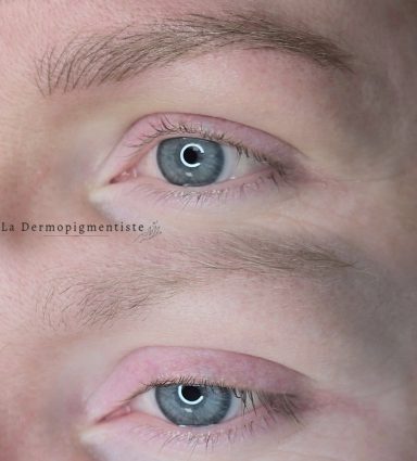 Deux yeux clairs avec des cils fins, affichant une peau légèrement rosée autour.