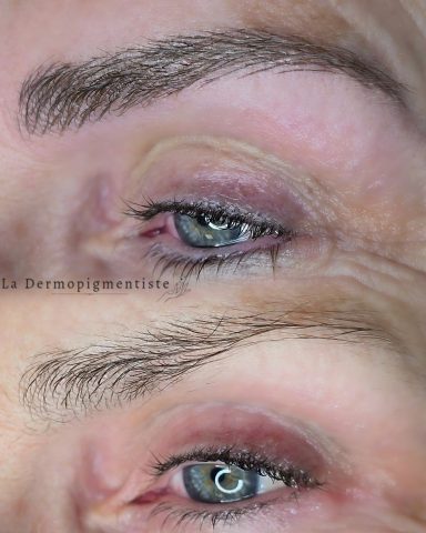 Comparaison de deux yeux montrant des différences de peau et d'hydratation autour des yeux.